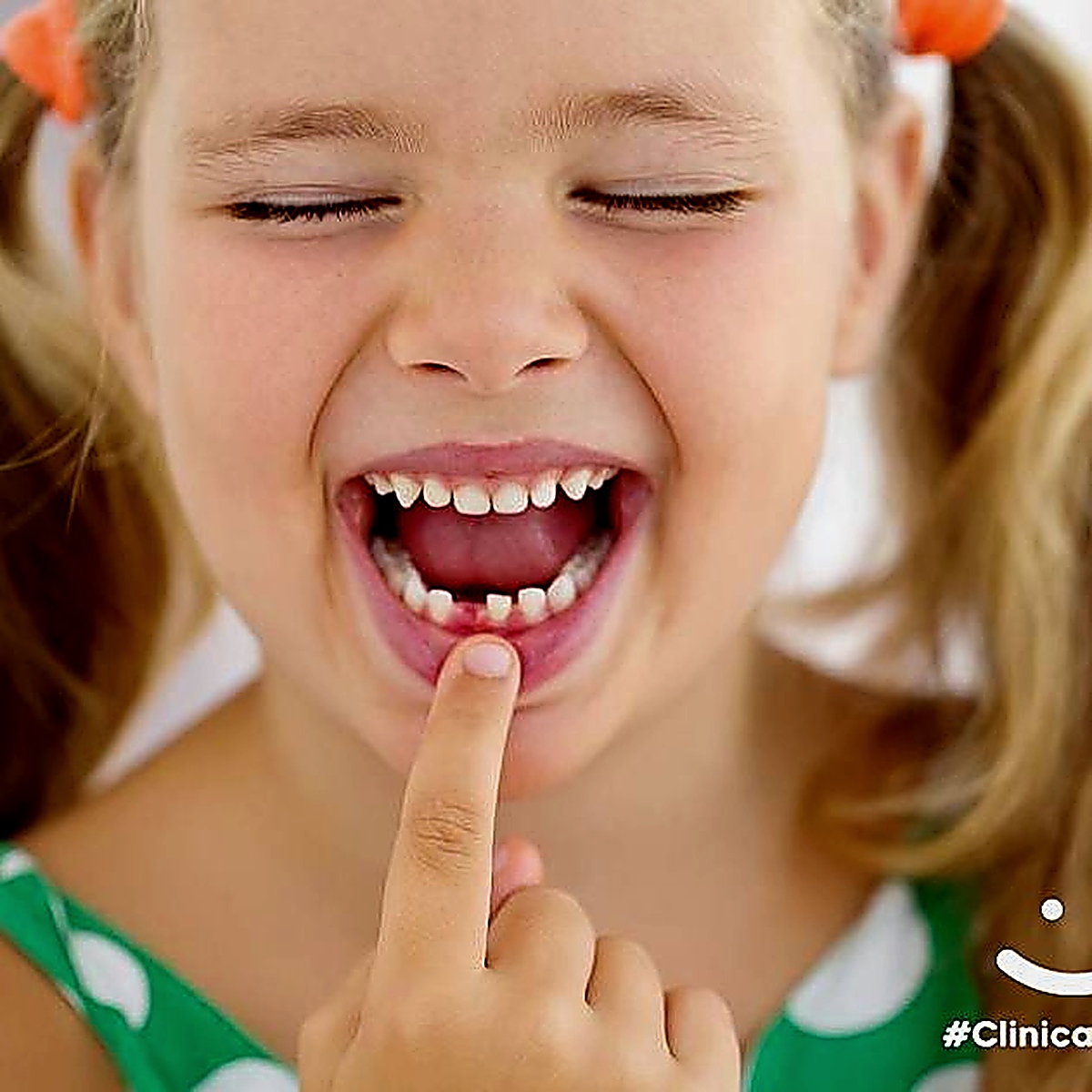 Odontopediatria em Fortaleza
