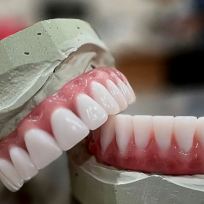 Próteses dentárias em Fortaleza